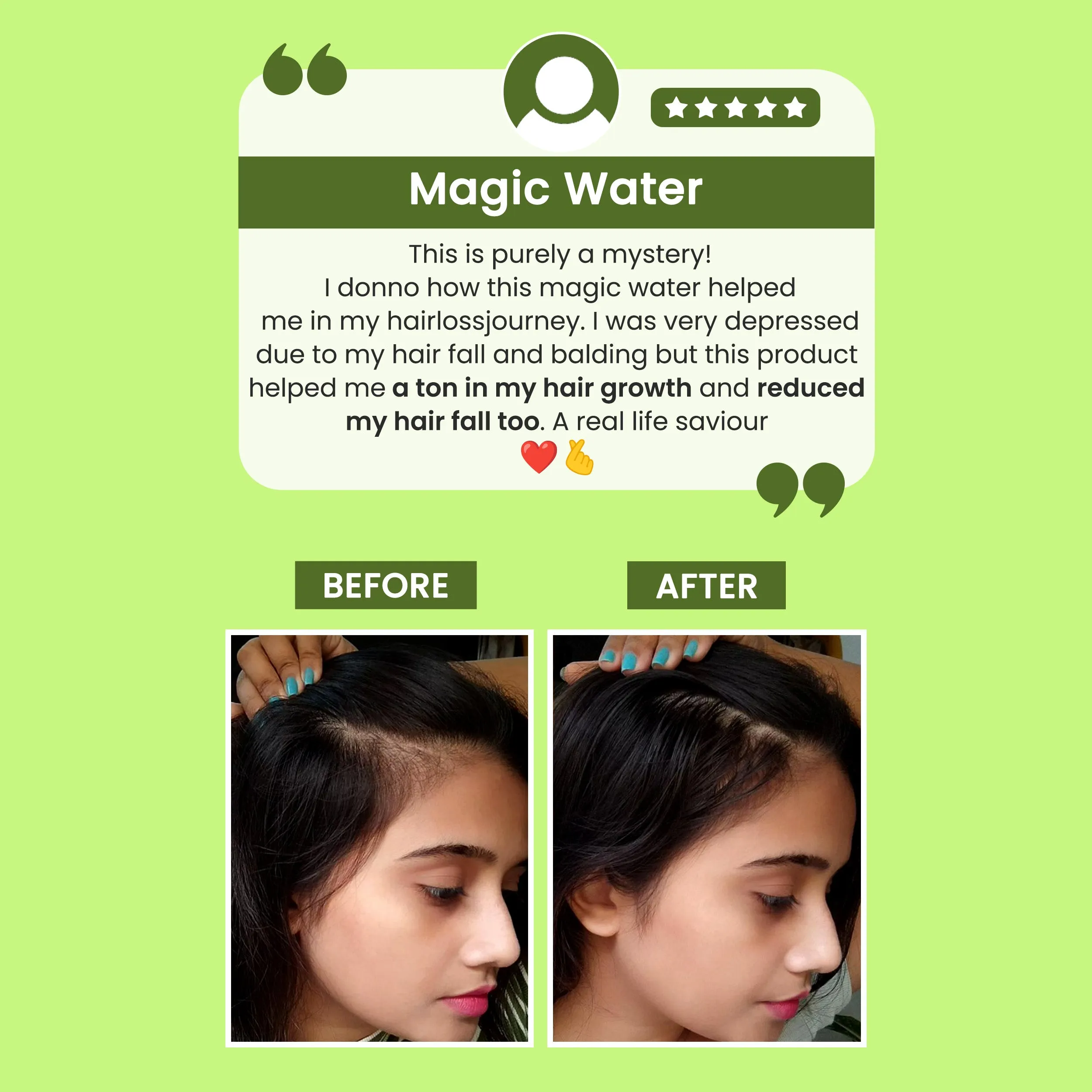 Alps Goodness Rosemary Water Spray (200ml) | Rosemary water for hair | Hair Spray for Hair Growth | Viral Rosemary Spray | #1 Bestselling Spray