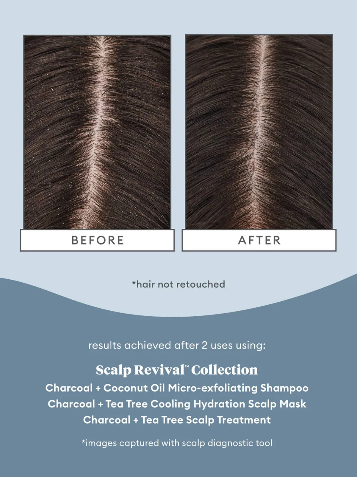BRIOGEO Scalp Revival charcoal   tea tree scalp treatment زيت معالج الشعر