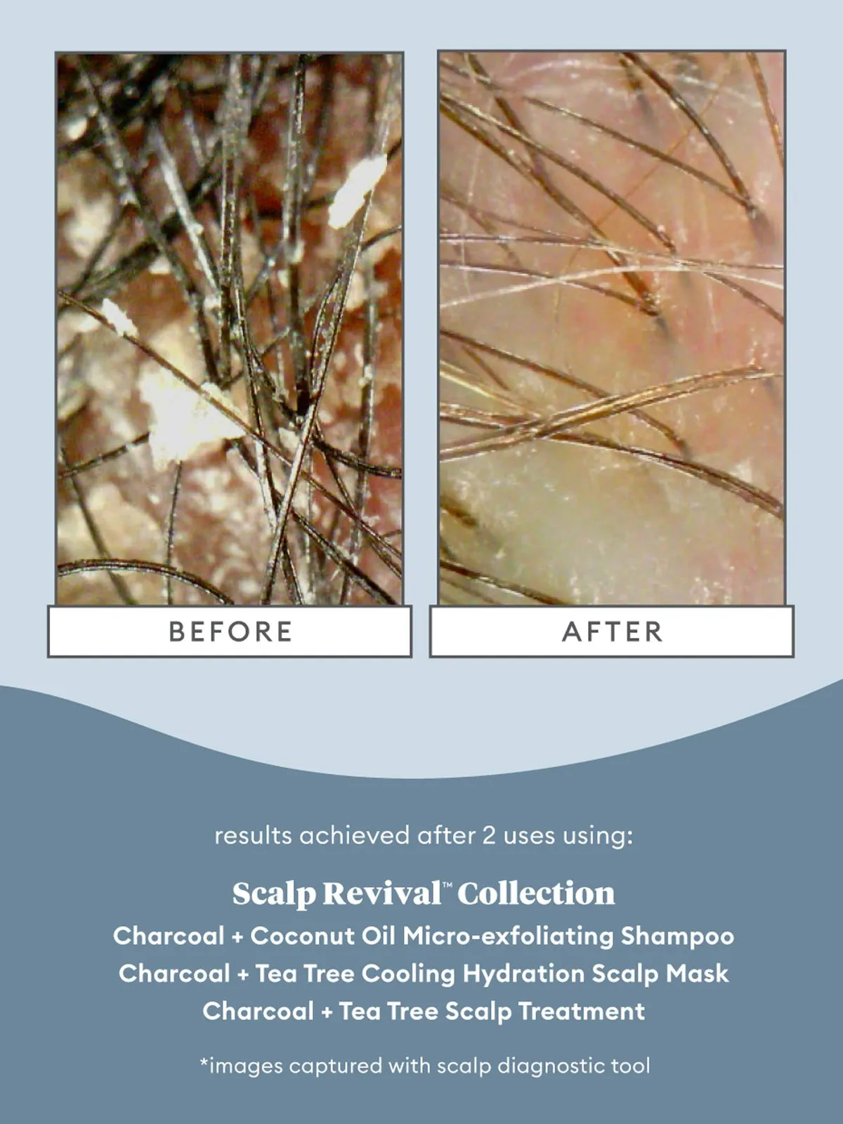 BRIOGEO Scalp Revival charcoal   tea tree scalp treatment زيت معالج الشعر
