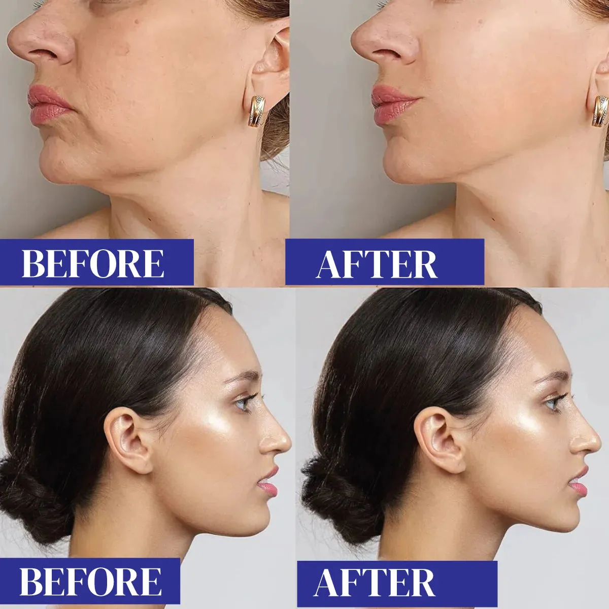 Double Chin Reducer Mask for Women Face Slimming, Adjustable Strap Belt for Perfect V Line Facial Lift JSB HF83