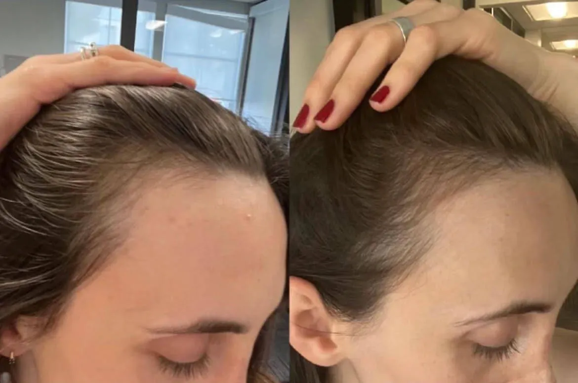 Growing Season - Burdock Hair Growth And Repair Oil