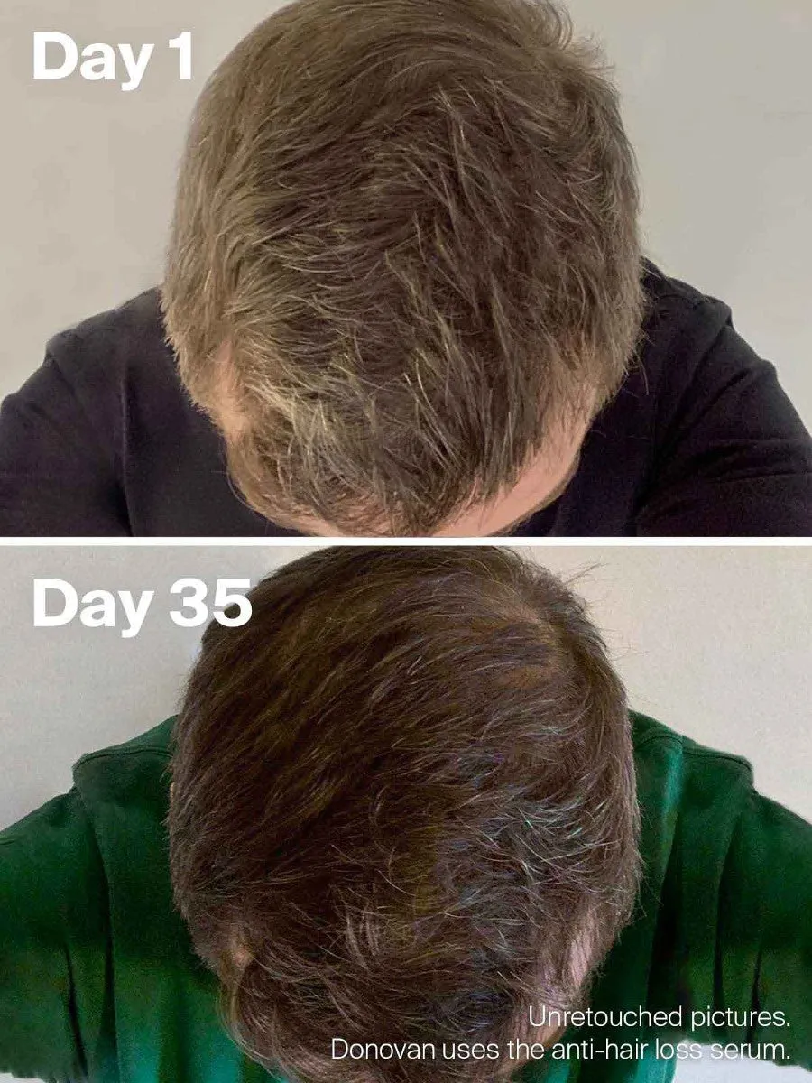 Horace Anti-Hair Loss Serum