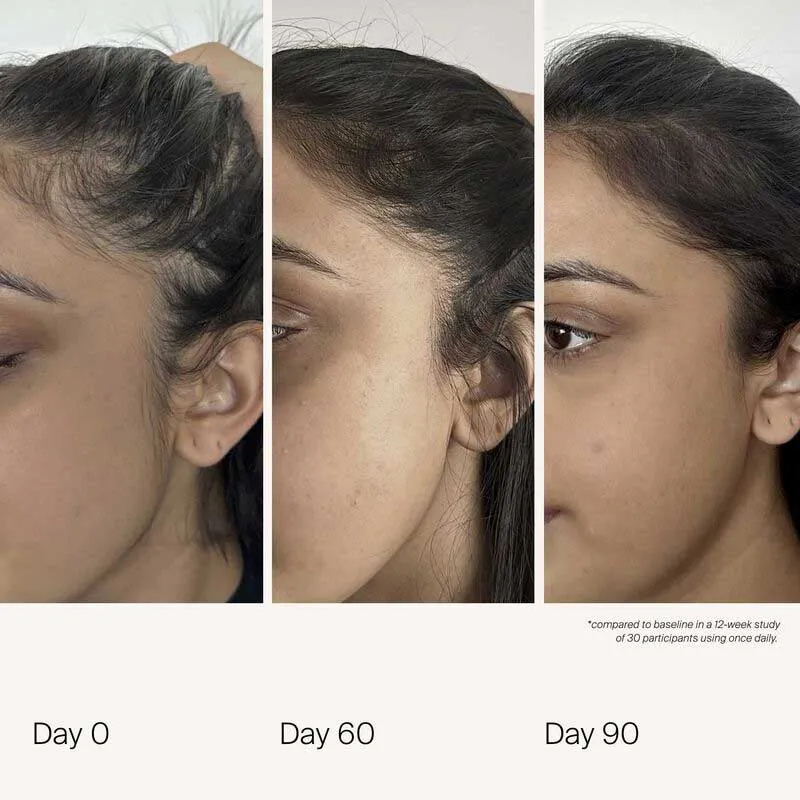 Living Proof Scalp Care Density Serum