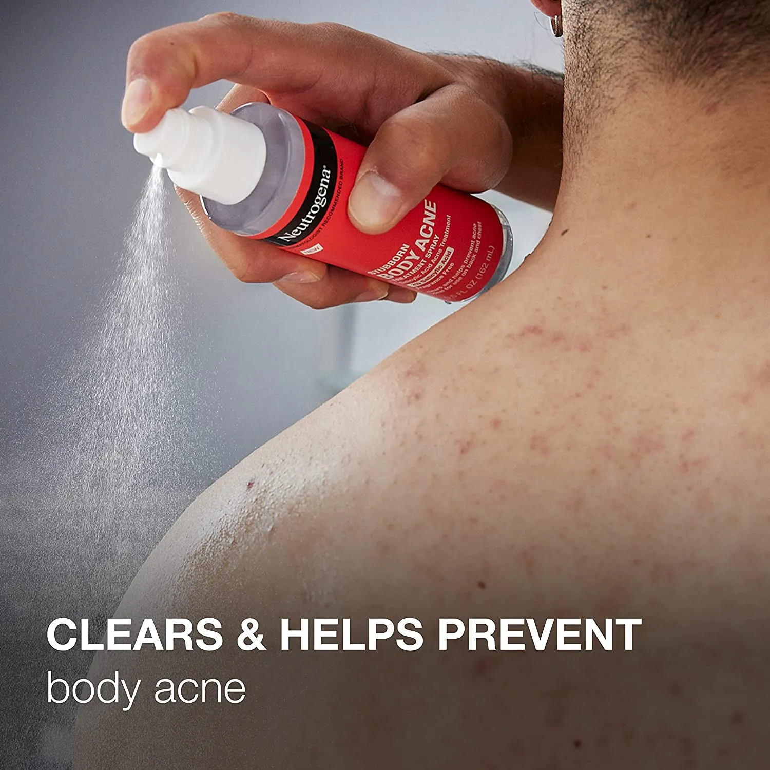 NEUTROGENA Stubborn Body Acne Treatment spray 2% Salicylic Acid Fragrance Free مست لعلاج حبوب الجسم