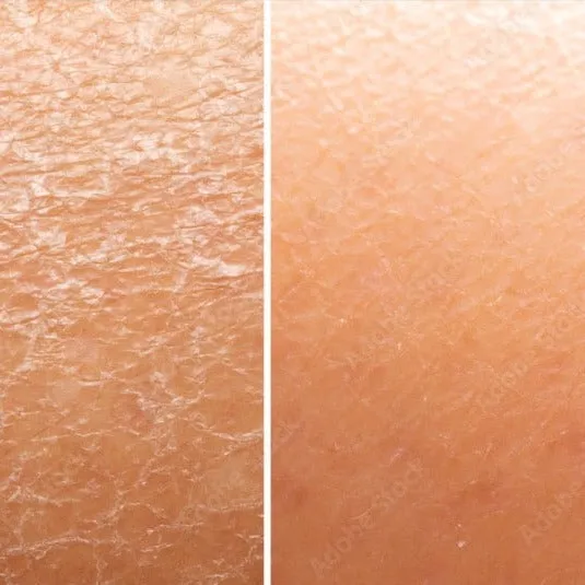 REFRESH Body Conditioning Oil