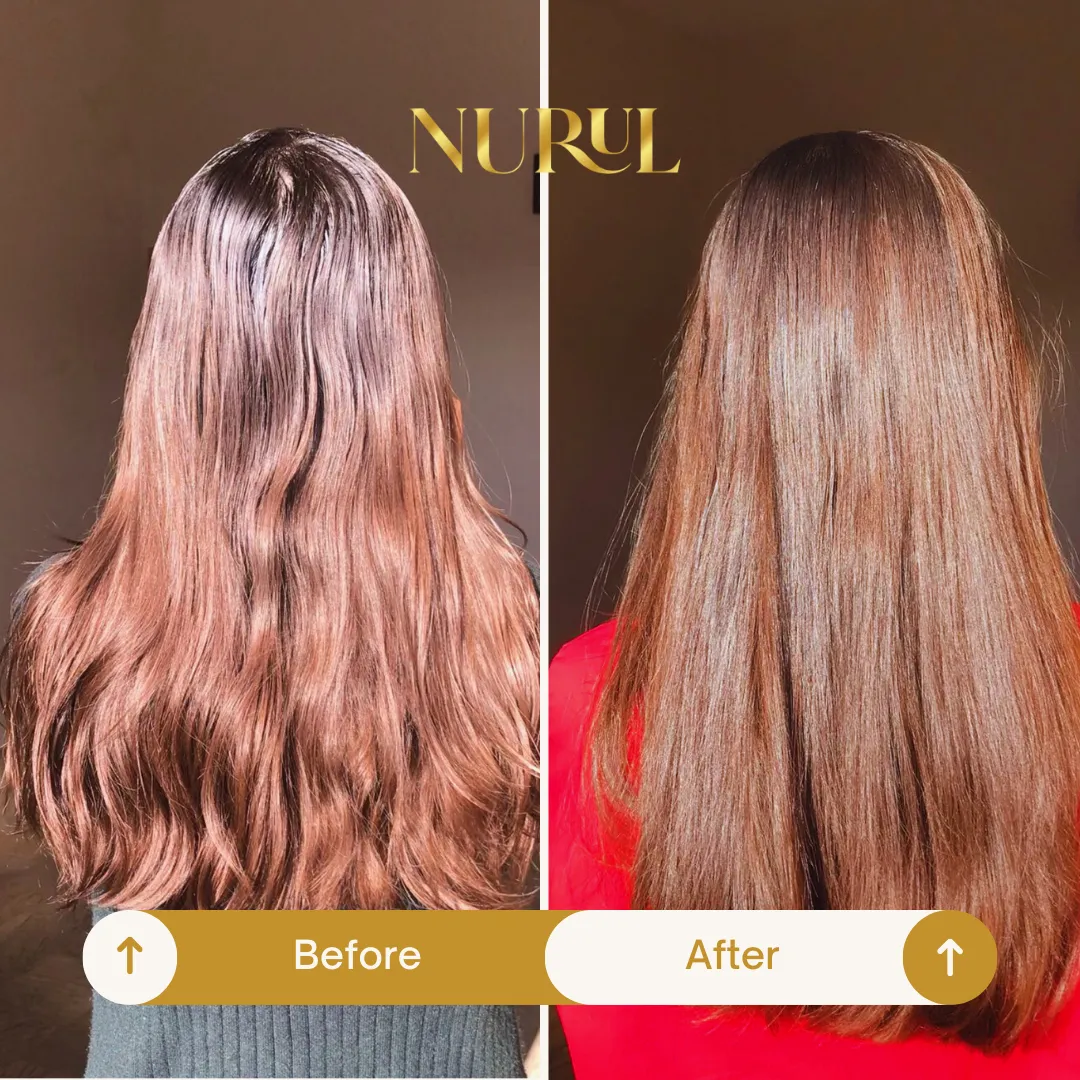 Scalp Treatment Hair Elixer Oil
