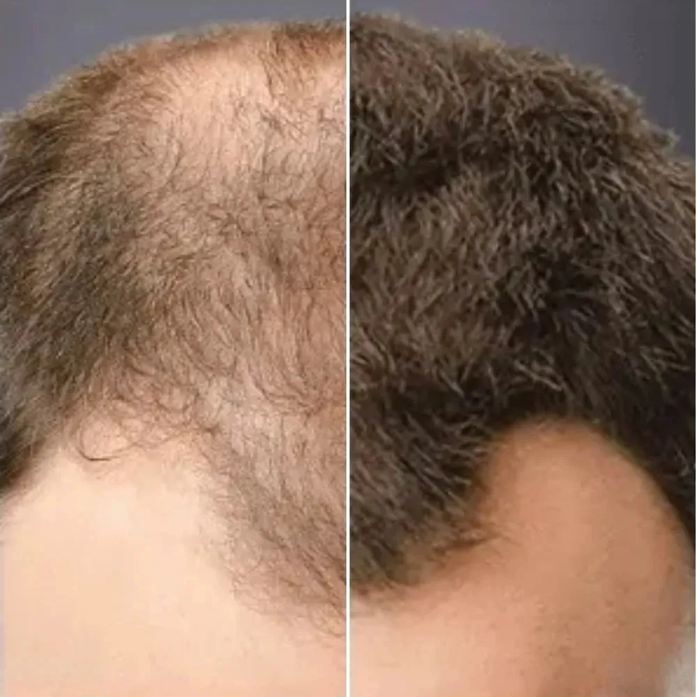 Toppik hair thickener color spray