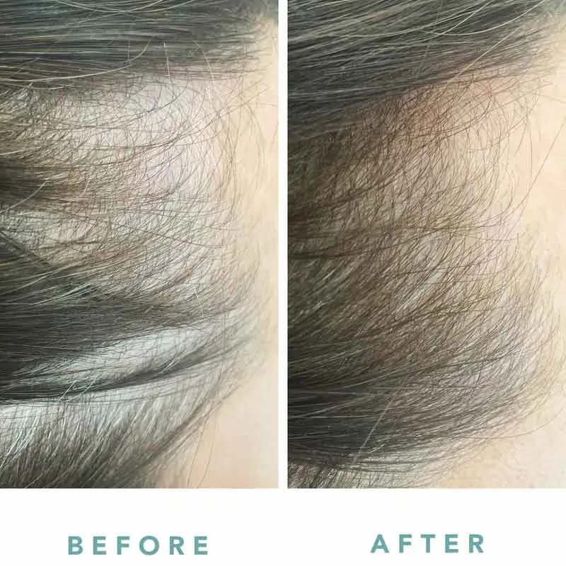 We Are Paradoxx Growth Accelerate Advanced Scalp Serum