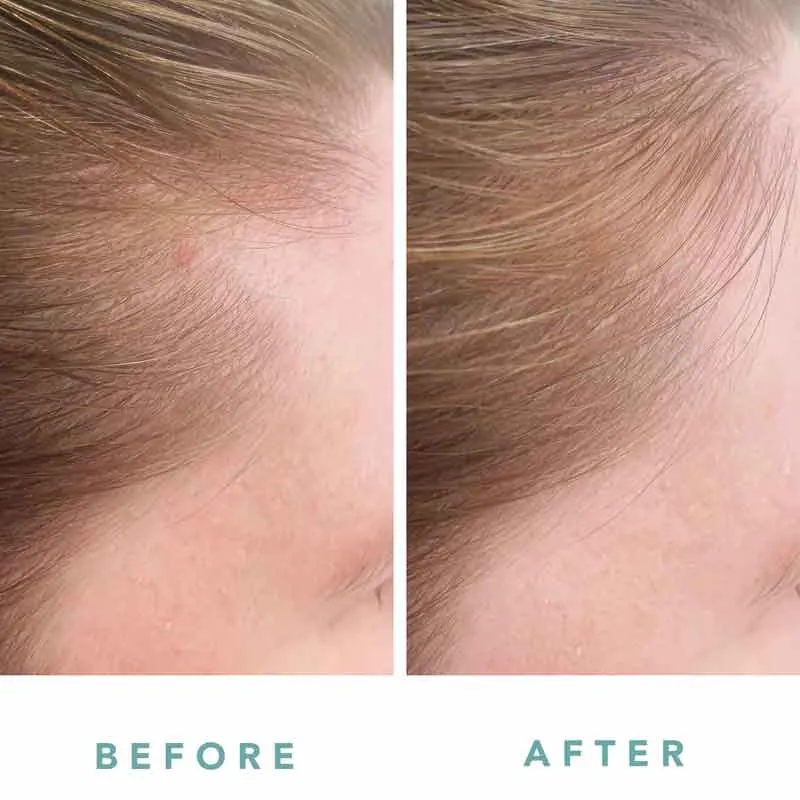 We Are Paradoxx Growth Accelerate Advanced Scalp Serum